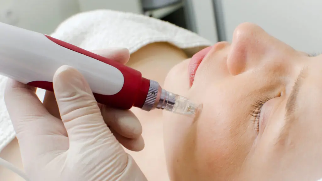 DermaPen Micro-Needling