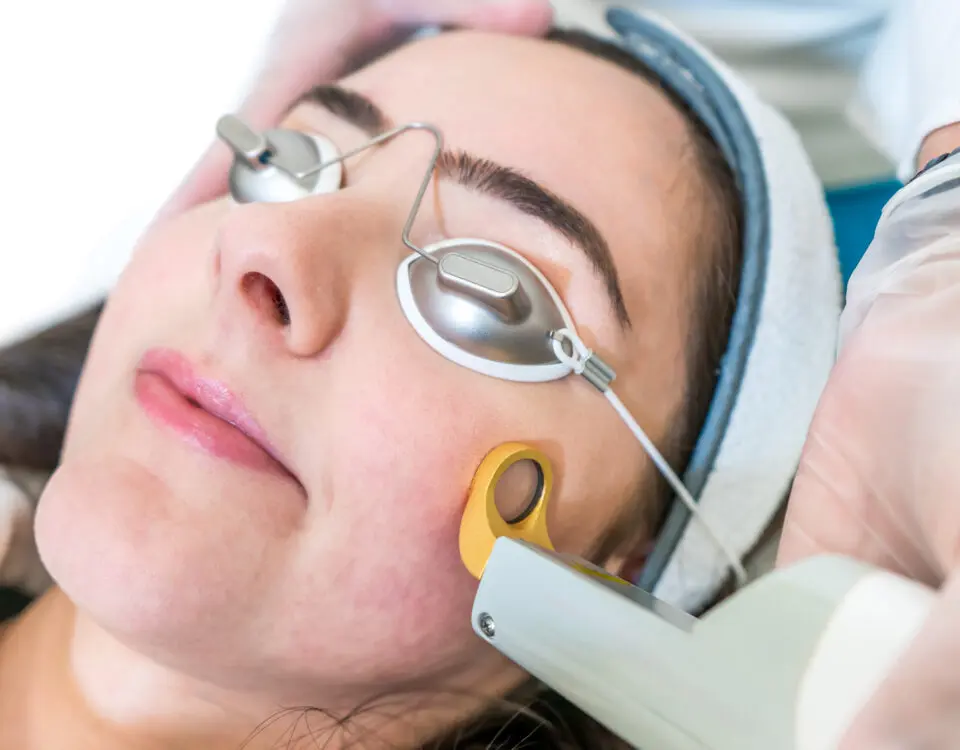 ND YAG LASER Acne Treatment