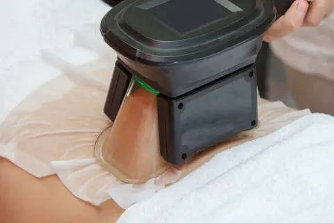 Cryolipolysis