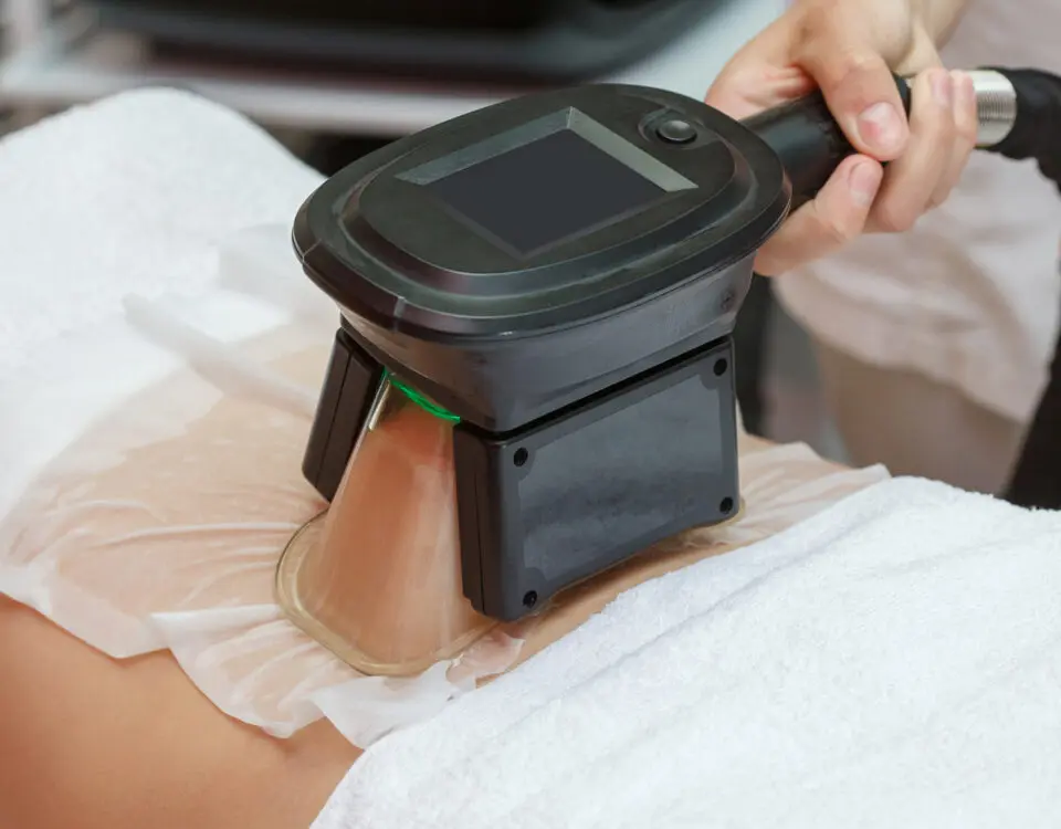 cryolipolysis treatment