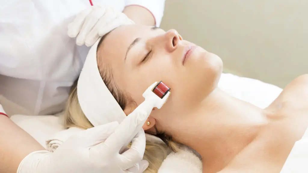 dermal roller