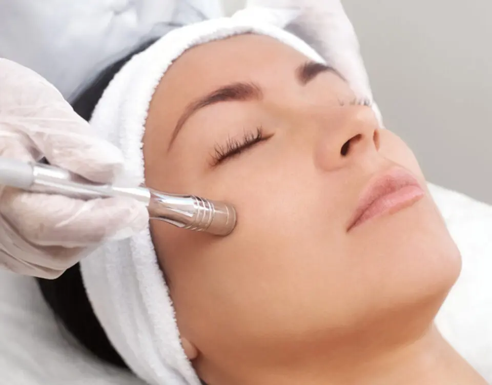 microdermabrasion