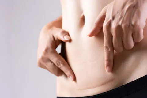 Scar Removal Treatment