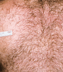 Before image
