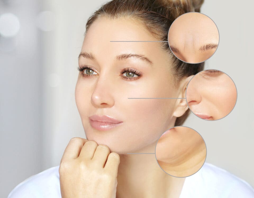 Anti Wrinkle Injections
