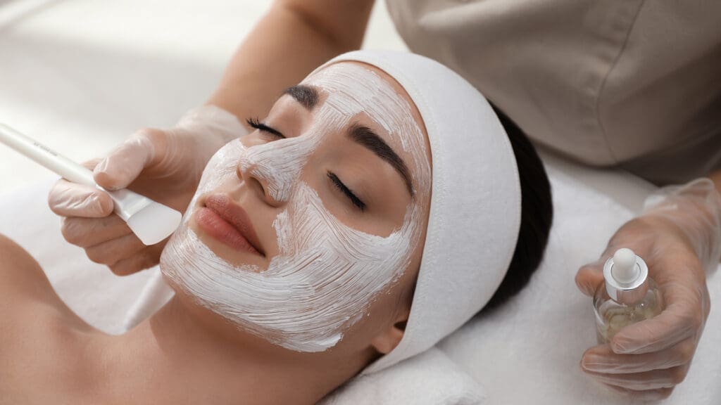 TCA Chemical Peel