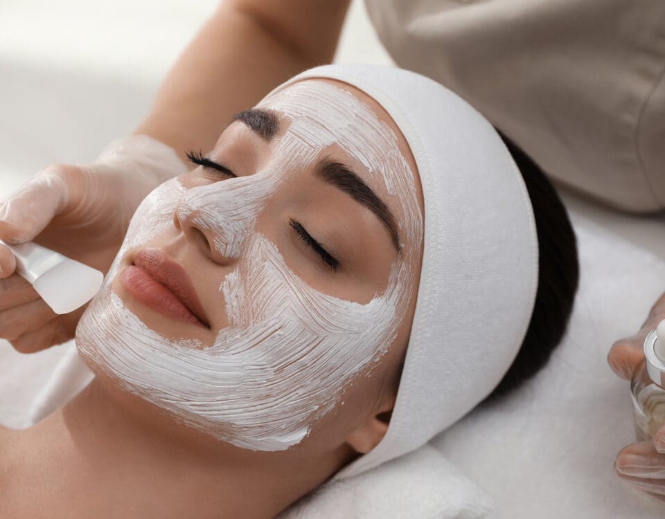 TCA Chemical Peel