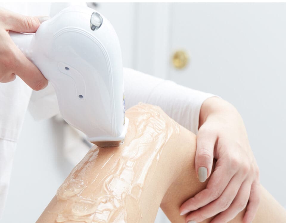 IPL Hair Removal