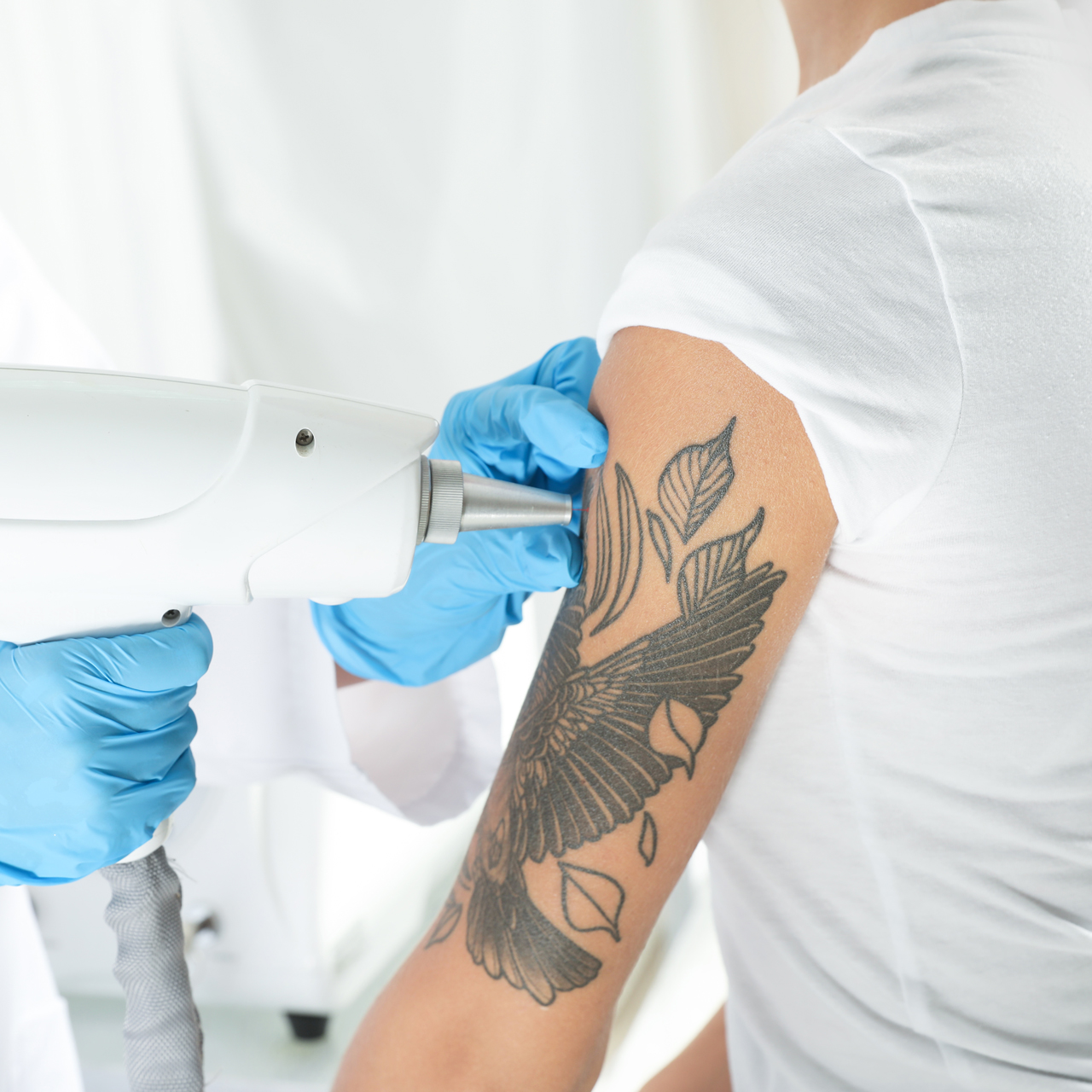 Tattoo Removal Sydney  Laser Removal Treatment  Contour Clinics