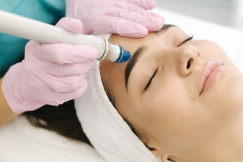 Microneedling