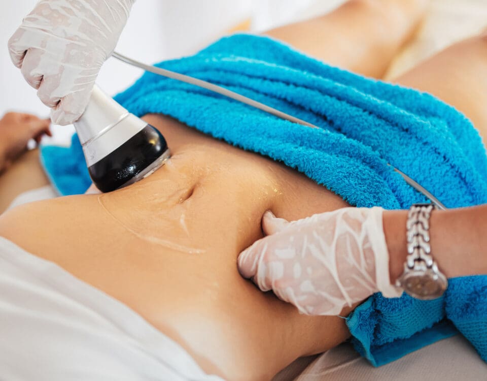 RF Body Sculpture