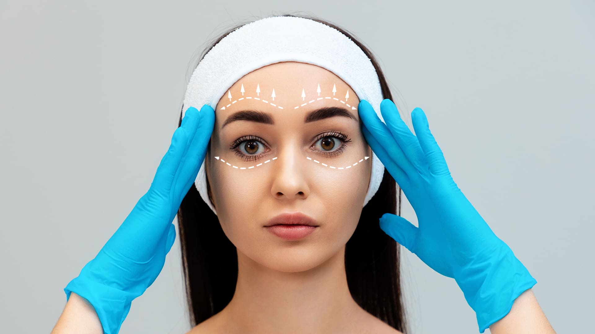 PDL Facial Threading with Silhouette Soft NL Clinic