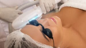 ipl photo rejuvenation