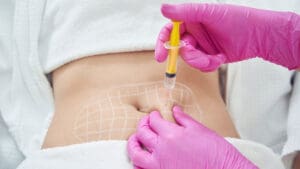 Fat Dissolving Injections