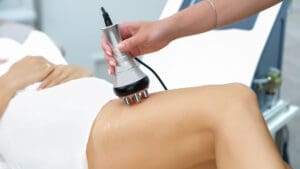 rf body sculpting legs