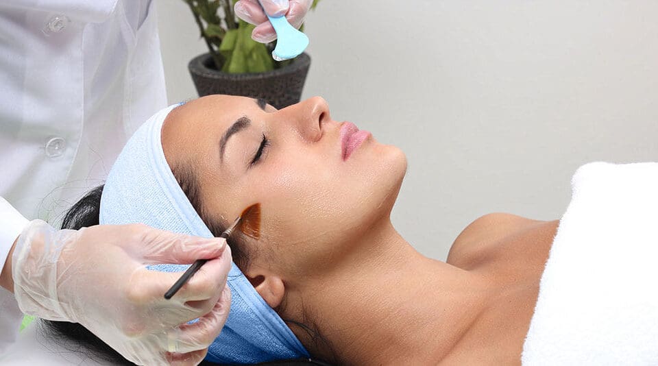 ZO Skin Peel