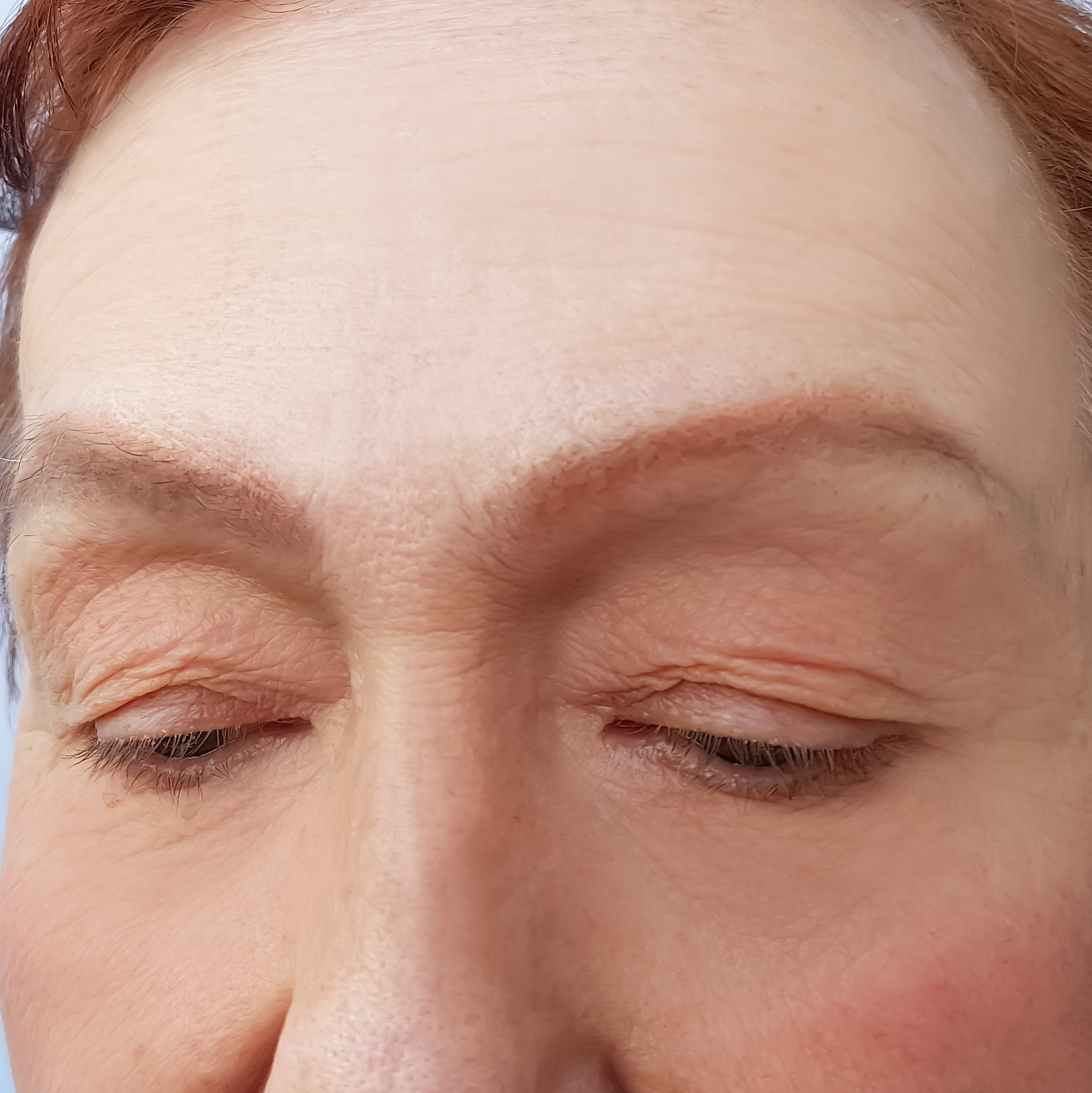 anti-wrinkle-after
