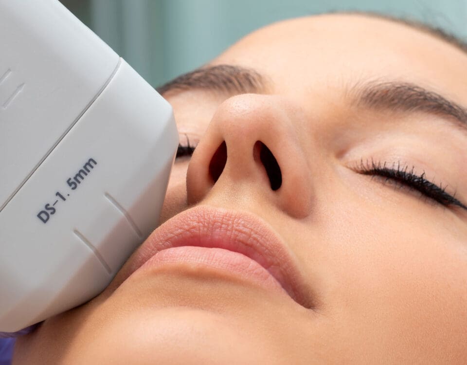 HIFU Periorbital